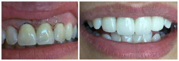 Dr.Seema Vohra-Dentist-Dubai,UAE